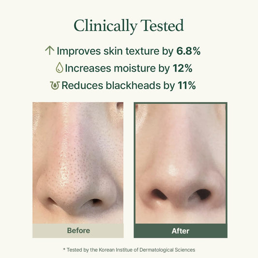 ARENCIA Korean Rice Mochi Face Cleanser Best Set [Fresh Green + Rosehip + Blue Hyssop + Calendula] - Deep Pore Cleansing, Acne Face Wash, Blackhead Remover for Sensitive & All Skin Types